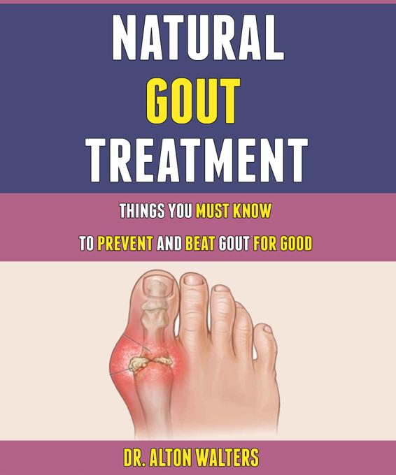 Natural Gout Treatment: Things You Must Know To Prevent And Beat Gout For Good.