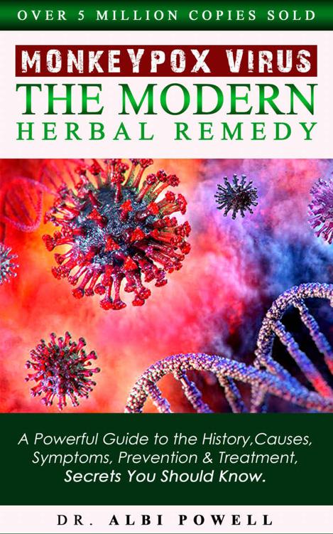 MONKEYPOX VIRUS: THE MODERN HERBAL REMEDY: A Powerful Guide to the History, Causes, Symptoms, Prevention & Treatment, Secrets You Should Know.